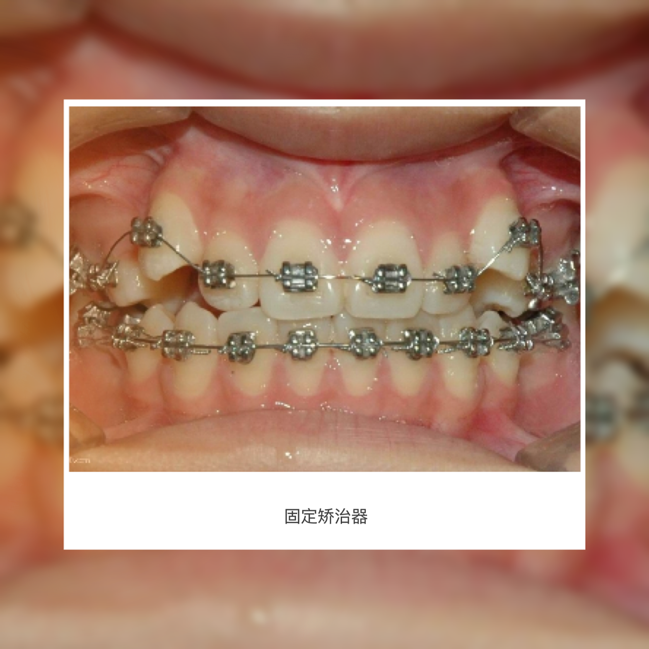 3db5303cd1e76c7de0b1caacf1047421.png